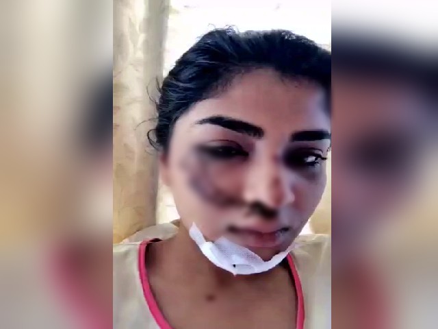 divya-suresh-bike-accident