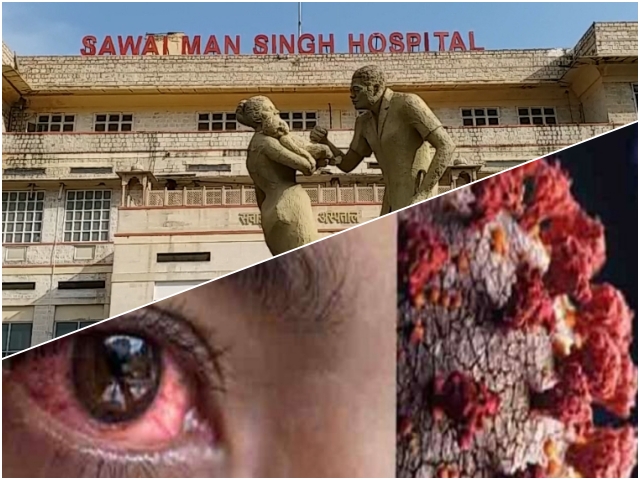 Cases of Black Fungus in SMS Hospital