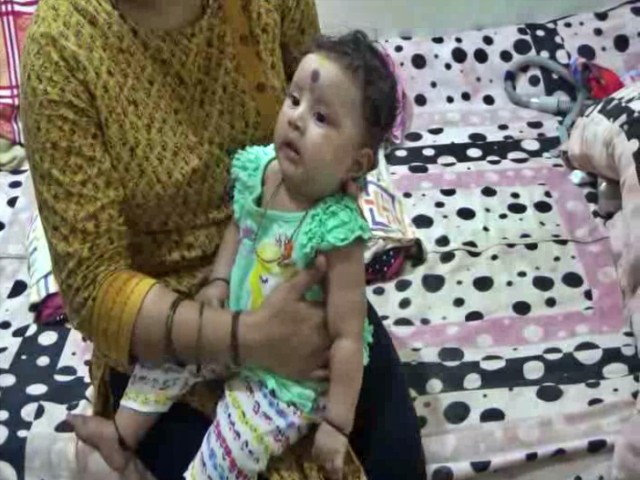 Haveri Child Suffering from Spinal muscular atrophy disease