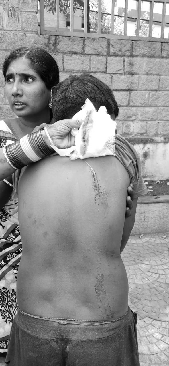 friends cut skin a boy with blade part of holi celebrations