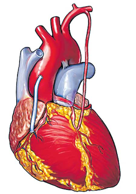 Open Heart Surgery Risks