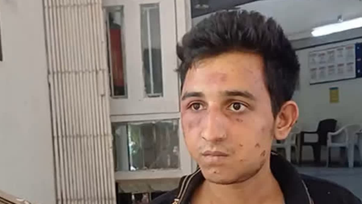 'Was Not Drunk', Says Vadodara Accident Accused After A Woman Dies In ...