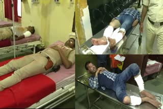 HUBBALLI  ROBBERS ARRESTED  DHARWAD  ಆರೋಪಿಗಳ ಕಾಲಿಗೆ ಗುಂಡೇಟು
