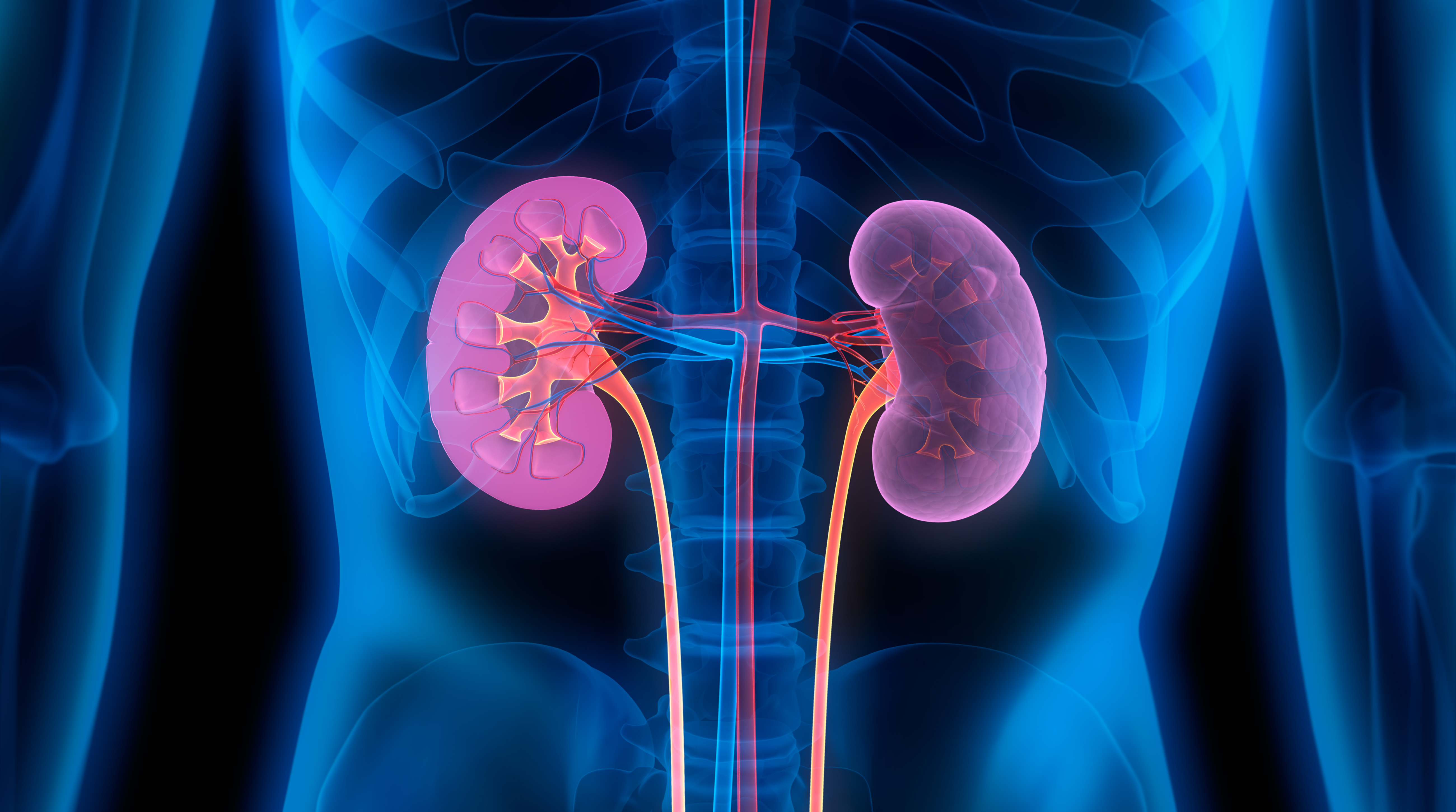 WHAT IS KIDNEY CANCER EARLY SIGNS OF KIDNEY CANCER SYMPTOMS OF KIDNEY CANCER HOW KIDNEY CANCER OCCURS