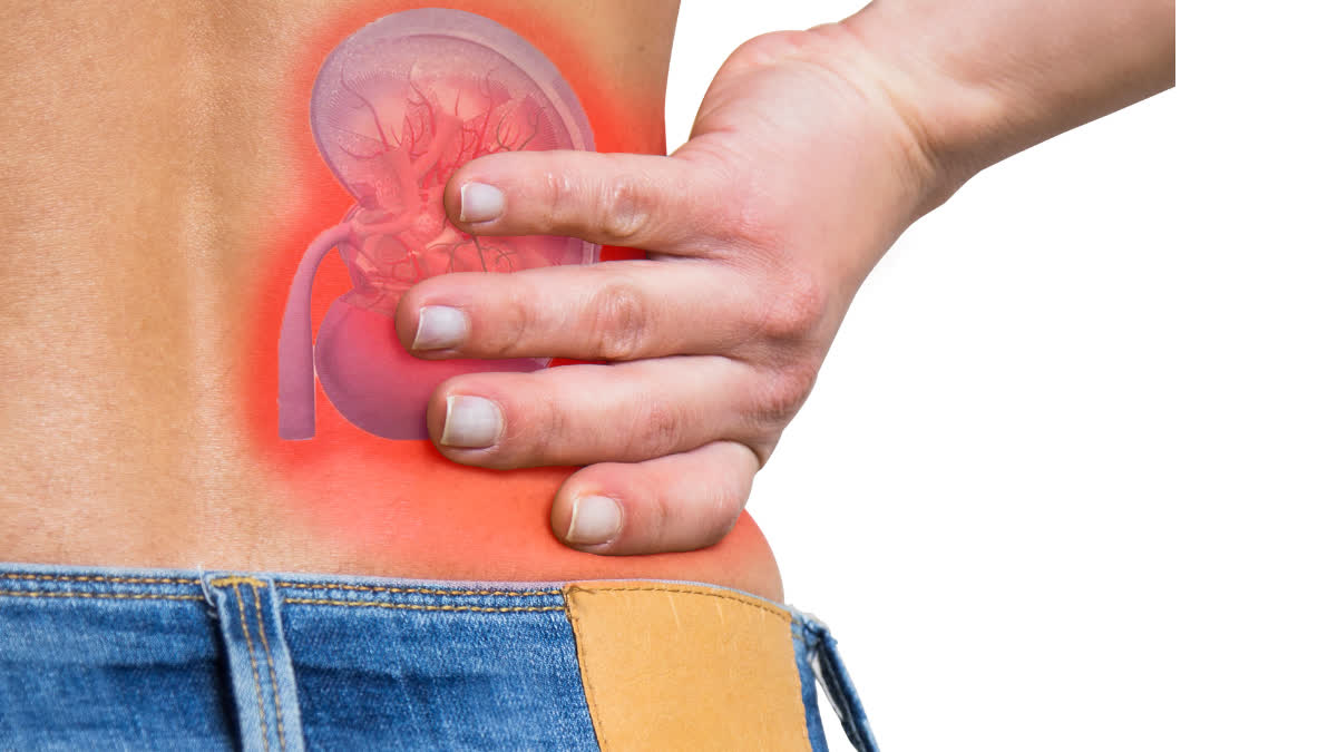 WHAT IS KIDNEY CANCER EARLY SIGNS OF KIDNEY CANCER SYMPTOMS OF KIDNEY CANCER HOW KIDNEY CANCER OCCURS