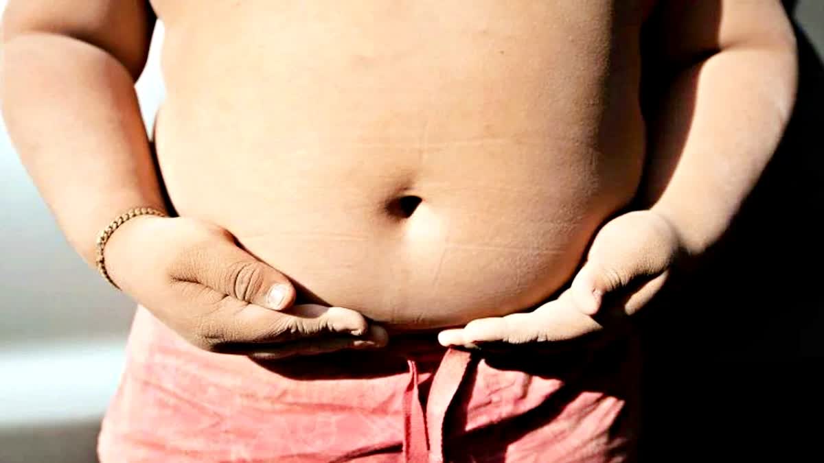 Children with severe obesity at age 4 may have a life expectancy of just 39: Study