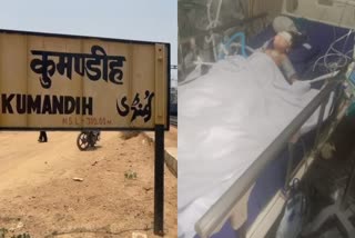 Two year old Pihu Kumari critical condition after train accident in Latehar