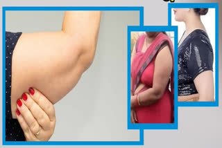 Arm Fat Reduce Exercises