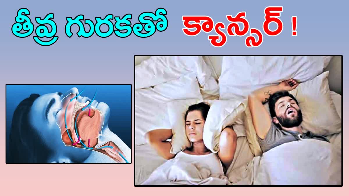 Treatment For Snoring Problem