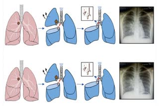 Robotic Surgery