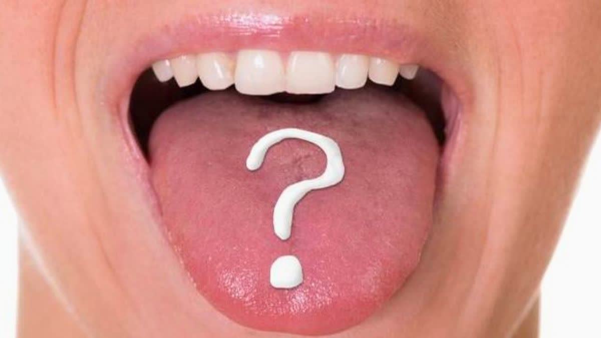 Tongue Color