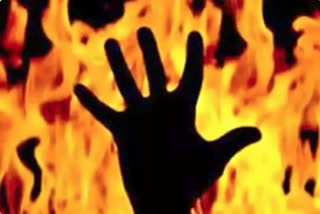 HUSBAND TRIED TO BURNED ALIVE