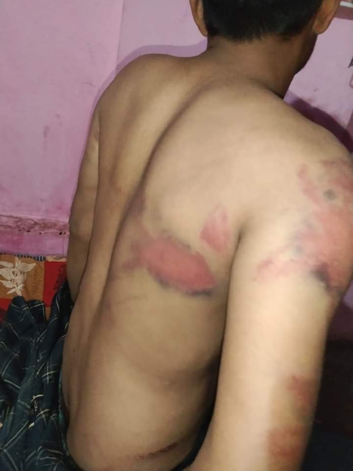 Adivasi Students Brutally Beaten