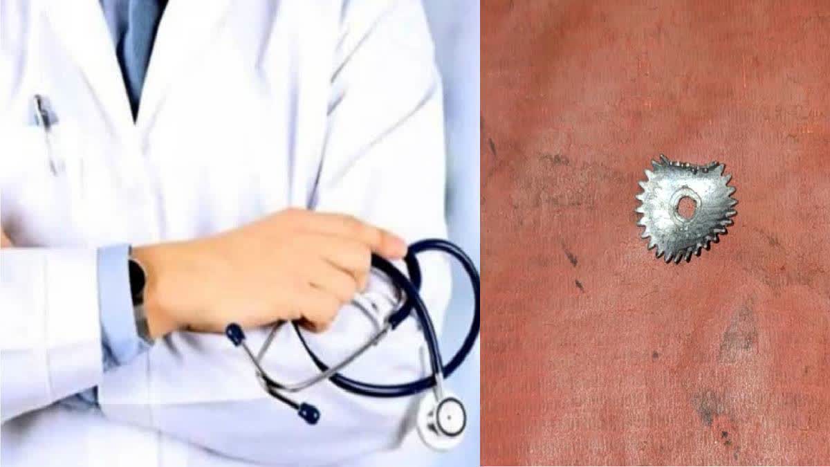 4-Yr-Old Swallows Toy Gearwheel In Purnea, Doctor Removes It Without Surgery