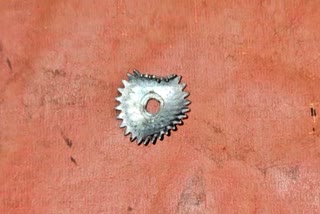 toy steel gear got stuck in throat