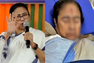 Mamata Banerjee  Mamata Banerjee Injury  West Bengal Chief Minister  Mamata Banerjees health