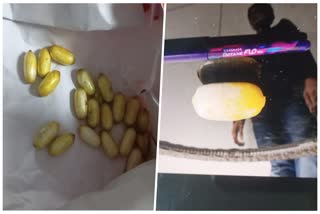 Indonesian youth arrested with cocaine inside stomach in LGBI Guwahati airport