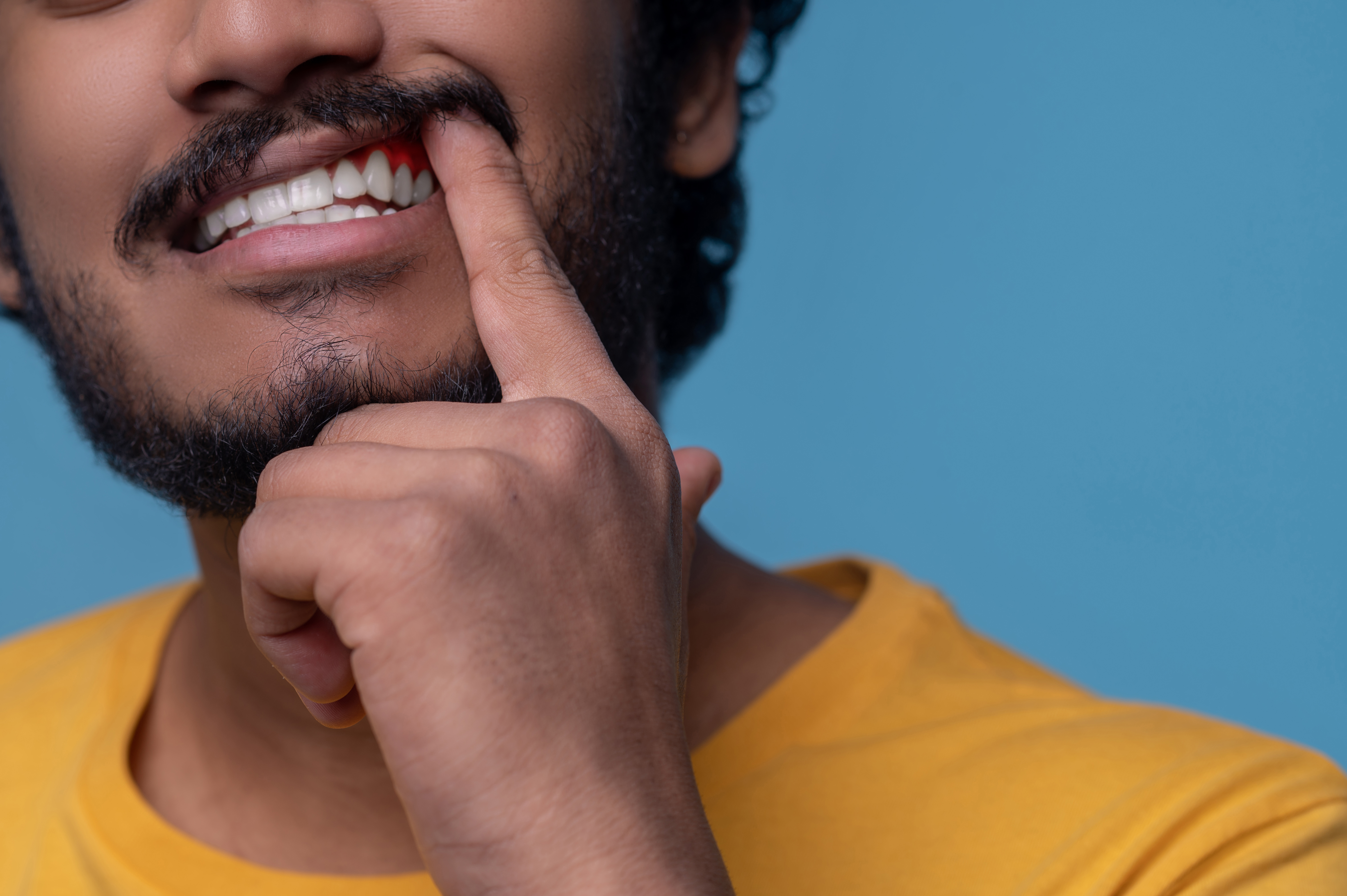 Do not ignore tartar in your teeth, it can cause many problems