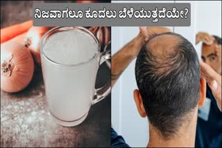 BENEFITS OF ONION JUICE  ONION JUICE BENEFITS FOR HAIR  ONION JUICE BENEFITS