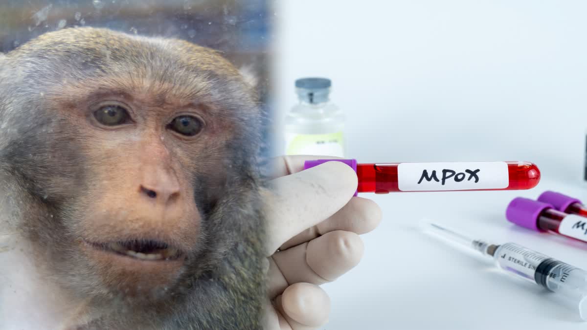 Monkeypox Virus In Pakistan