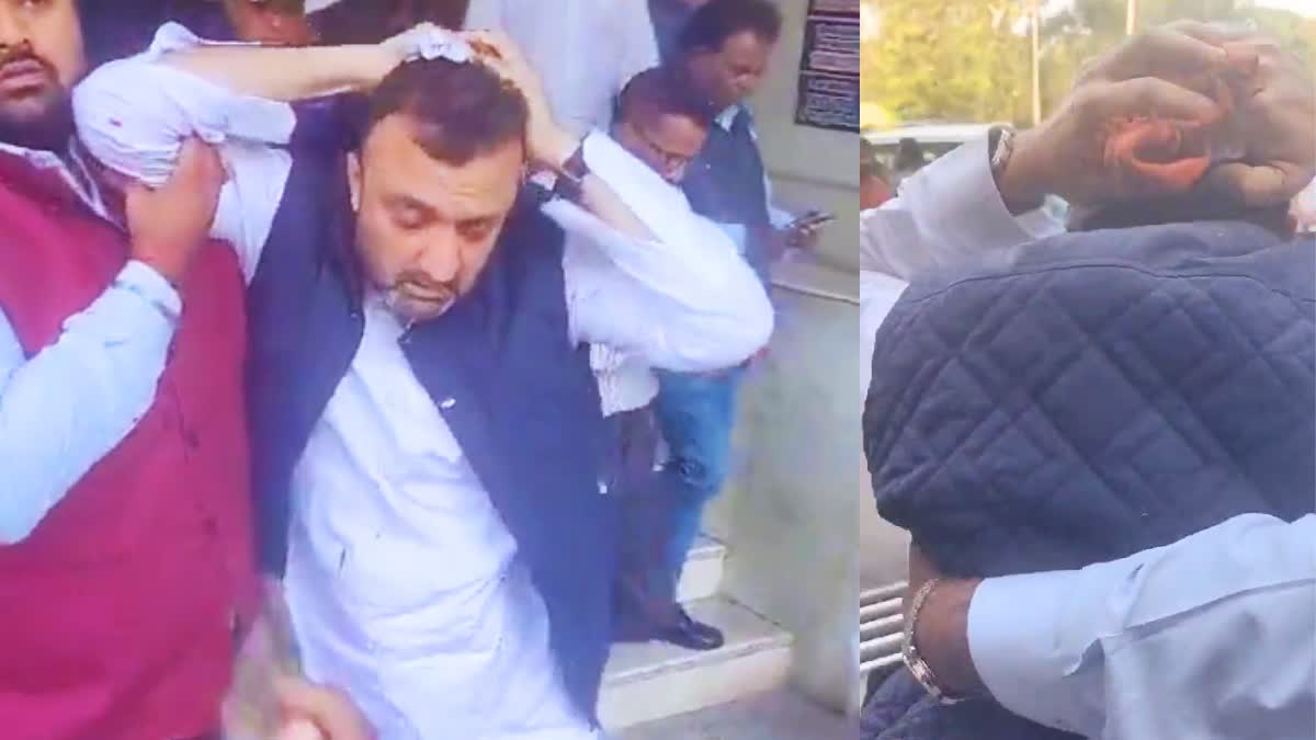 Congress Leader Anas Pathan Attacked