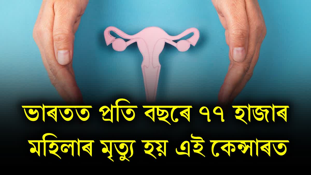 Cervical cancer is killing 77 thousands of women every year in India, know the initial symptoms and causes