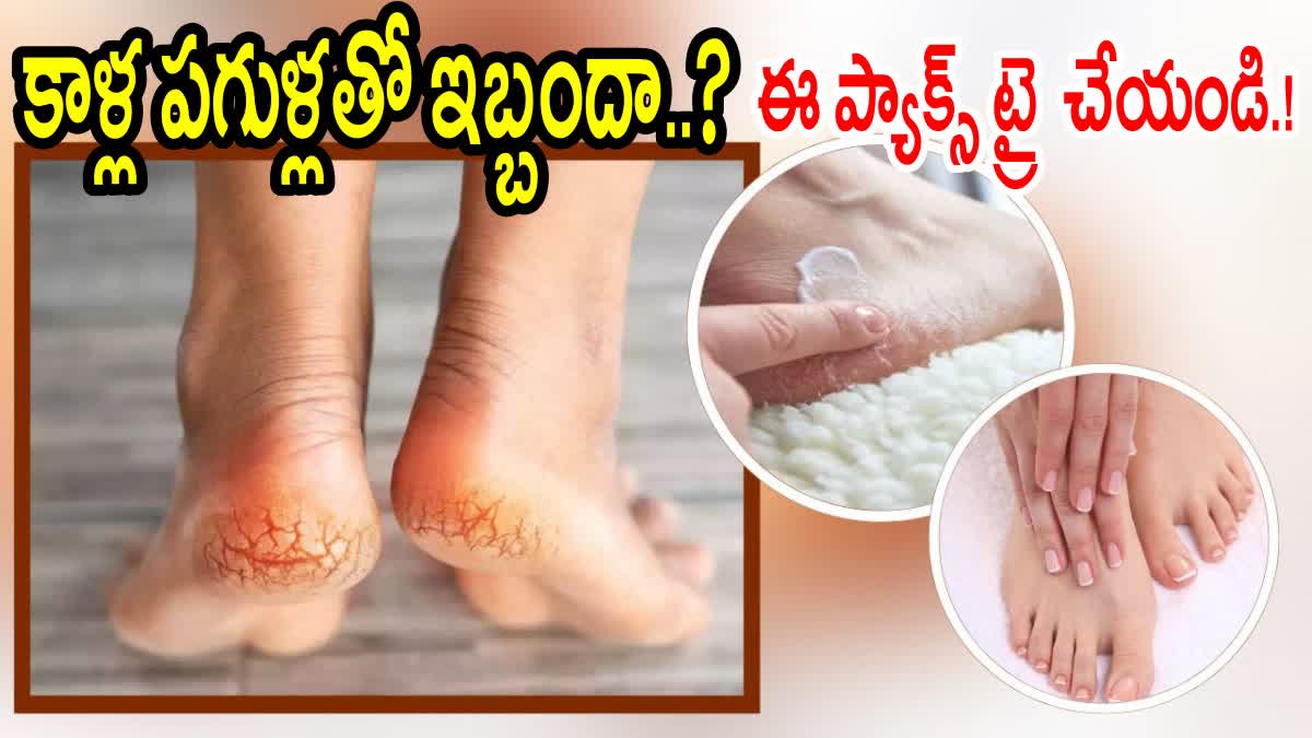 Home Remedies for Cracked Heels