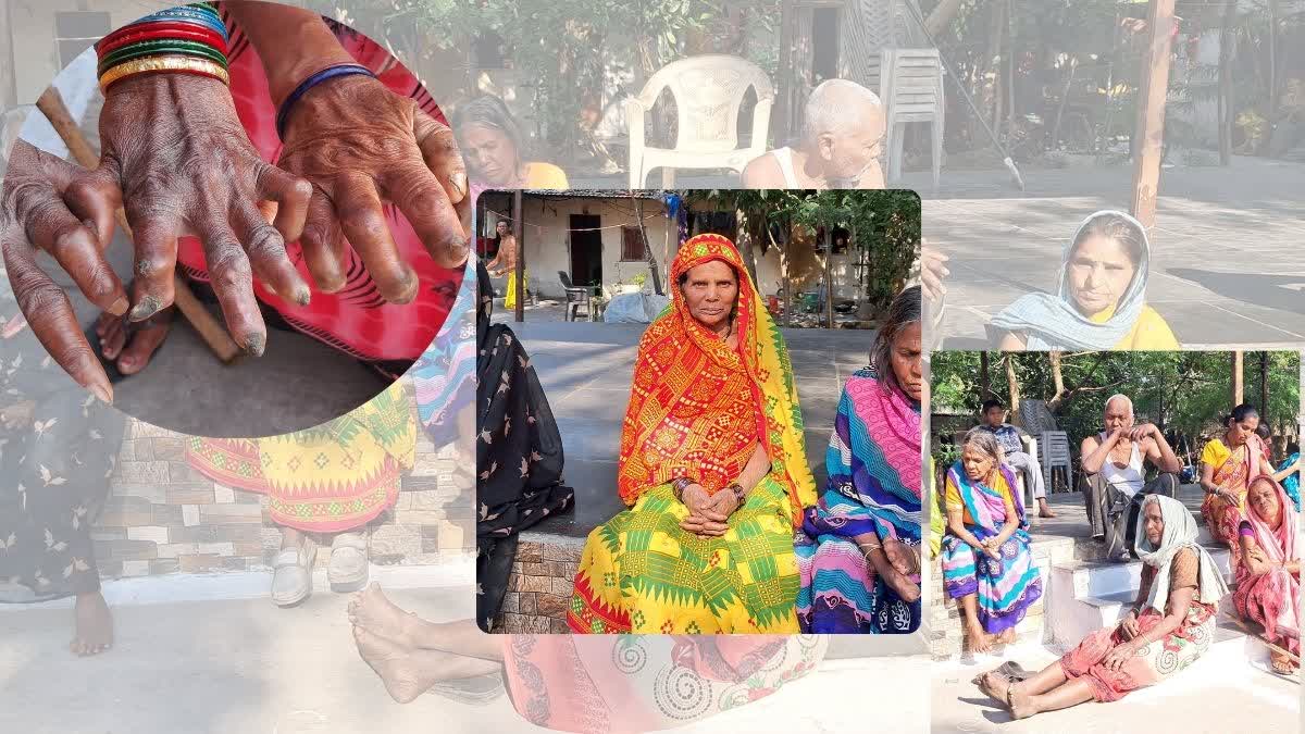 Leprosy patients not getting government schemes