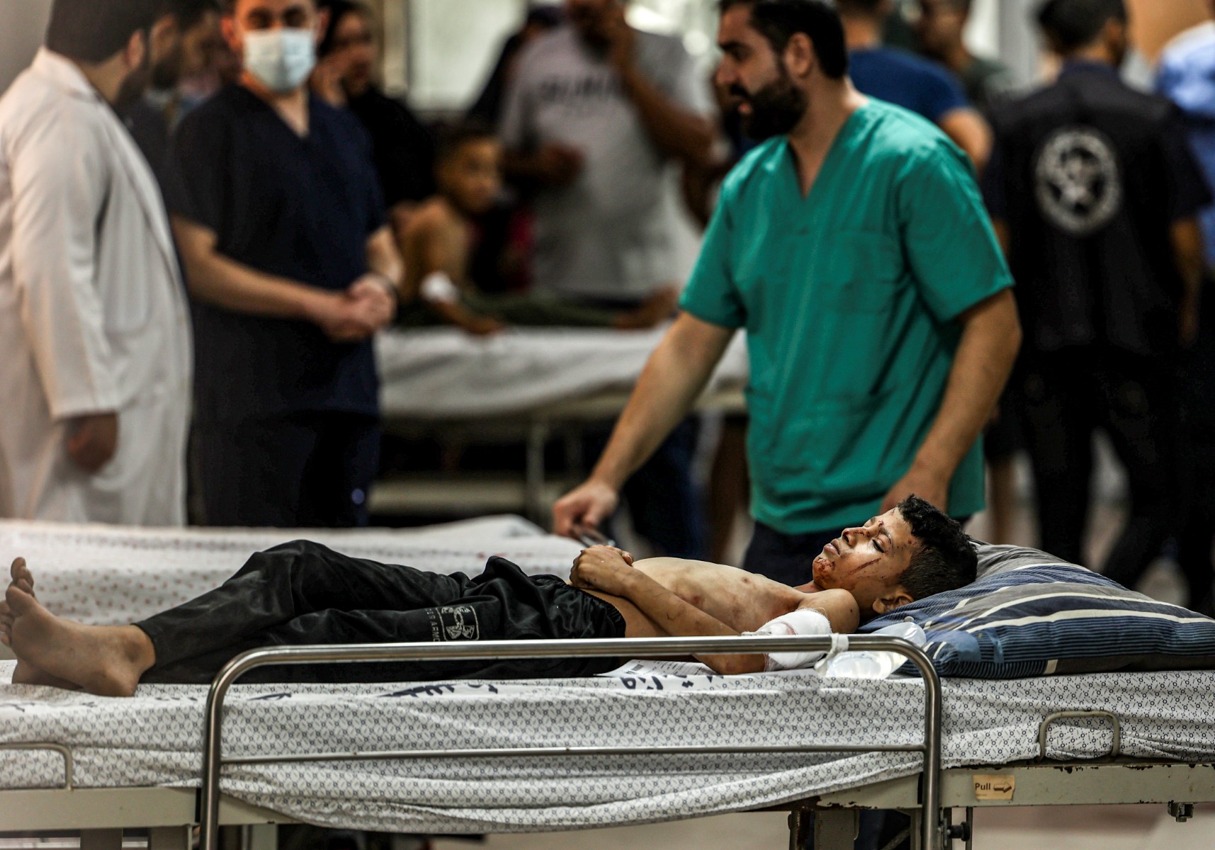 Palestinian child injured in Israeli attack