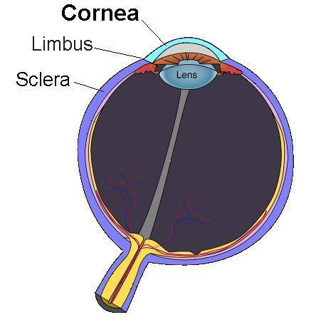 Cornea Disease