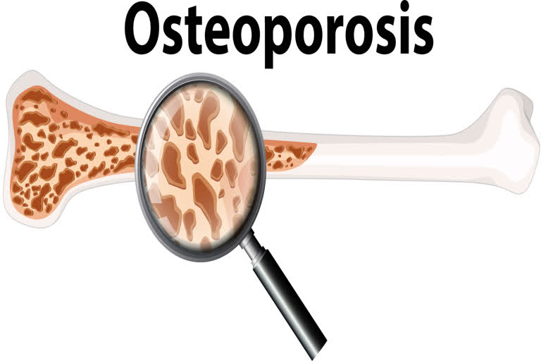 world osteoporosis day theme serve up bone strength theme world osteoporosis day theme