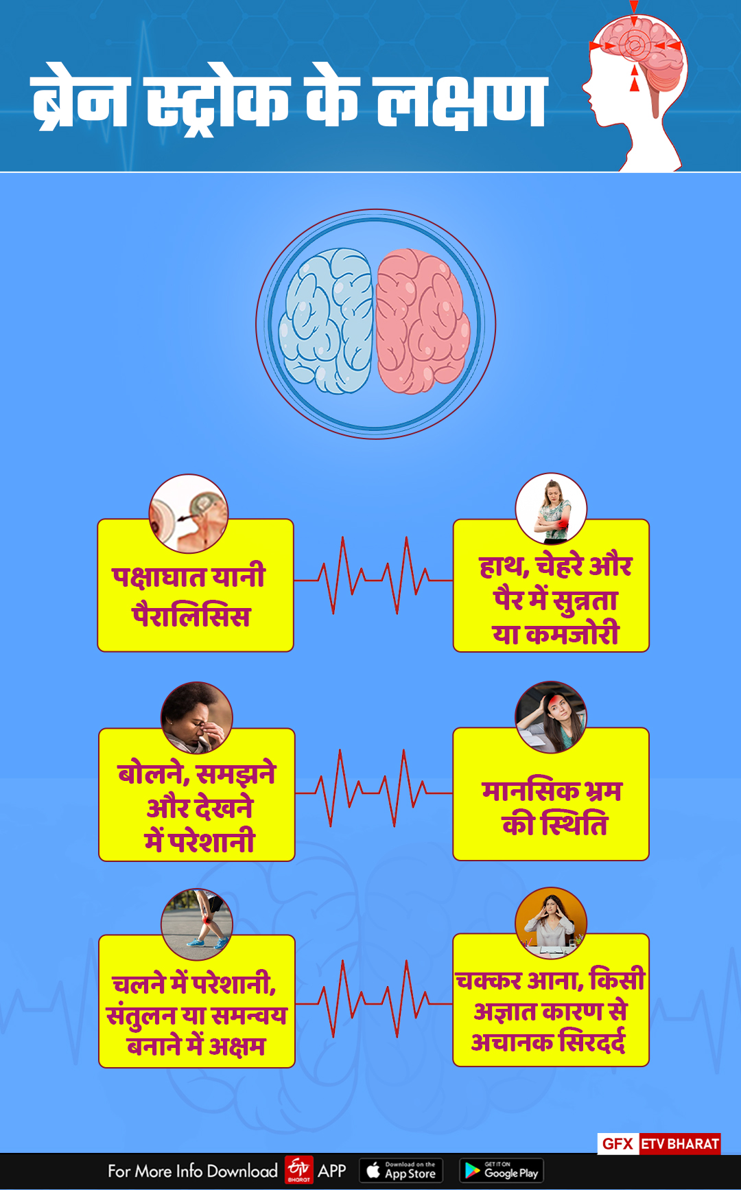 World Stroke Day