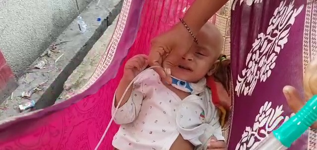 baby breathing through foot pump