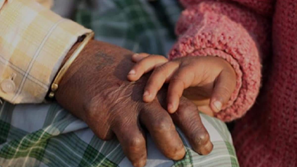 Misdiagnosis Worsening Leprosy Crisis, Specialists Also Failing, Reveals Study