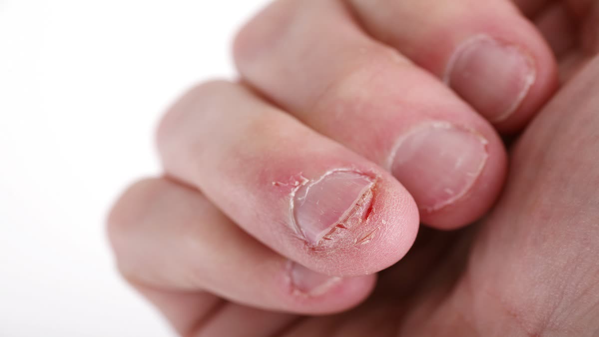 Tips To Prevent Nail Breakage