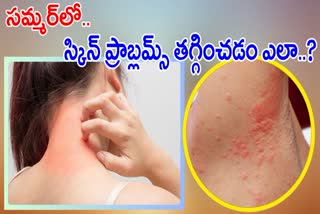 Skin Rashes In Summer Home Remedies