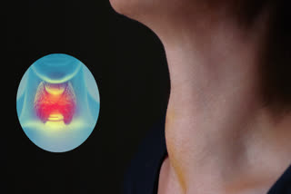 THYROID CANCER TREATMENT