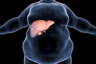 Fatty Liver Signs