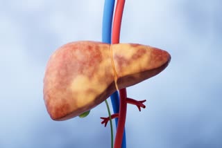 FATTY LIVER SYMPTOMS
