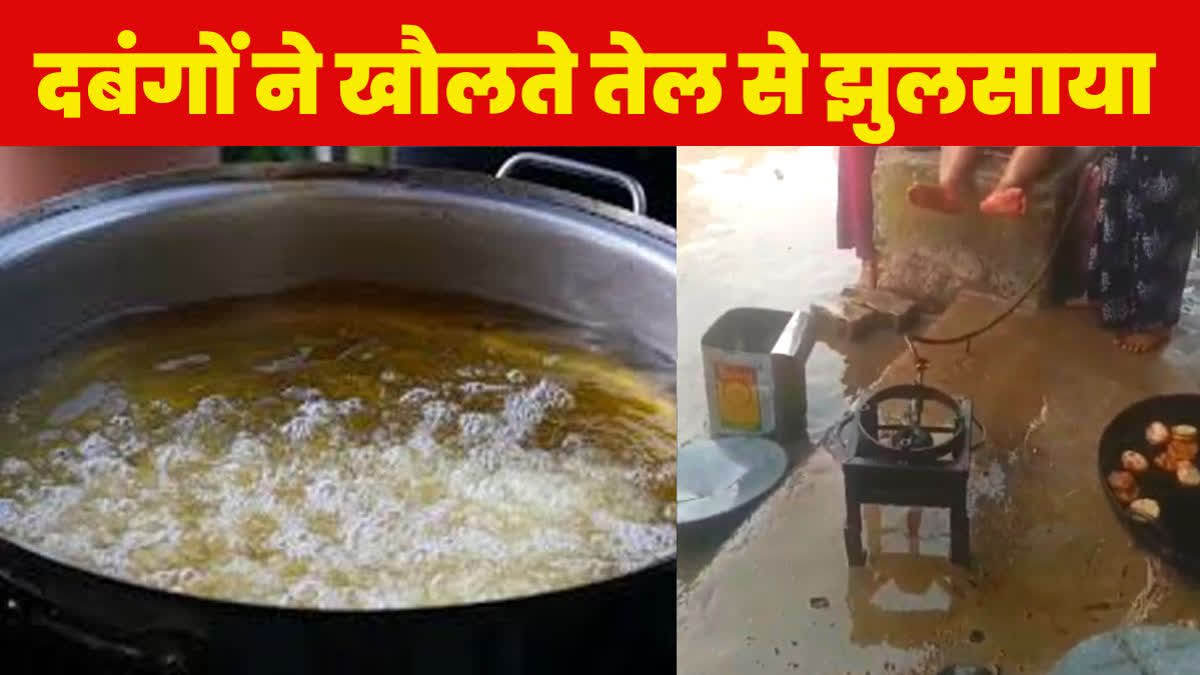 गया में दबंगों ने खौलते तेल से झुलसाया