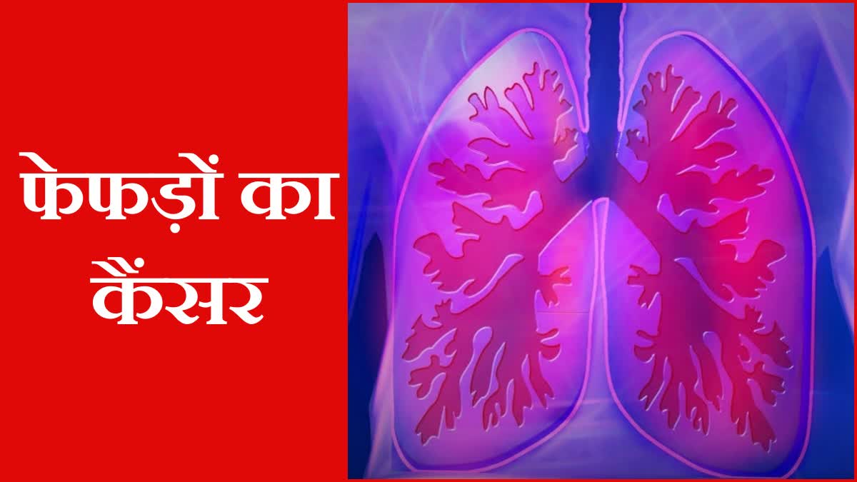 Lung cancer symptoms World Lung Day 2023