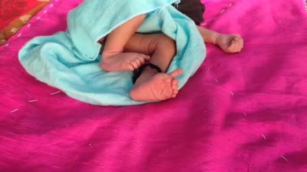 Rare occurrence: Rajasthan baby born with 14 fingers and 12 toes