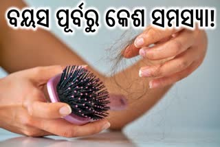 youngsters suffering from hair loss problem