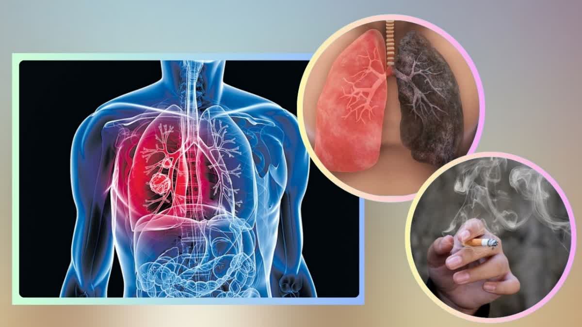 Lung Cancer Causes in Non Smokers