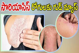 Psoriasis Skin Disease Causes