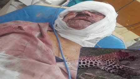 The leopard that attacked a farmer in Binjour was killed