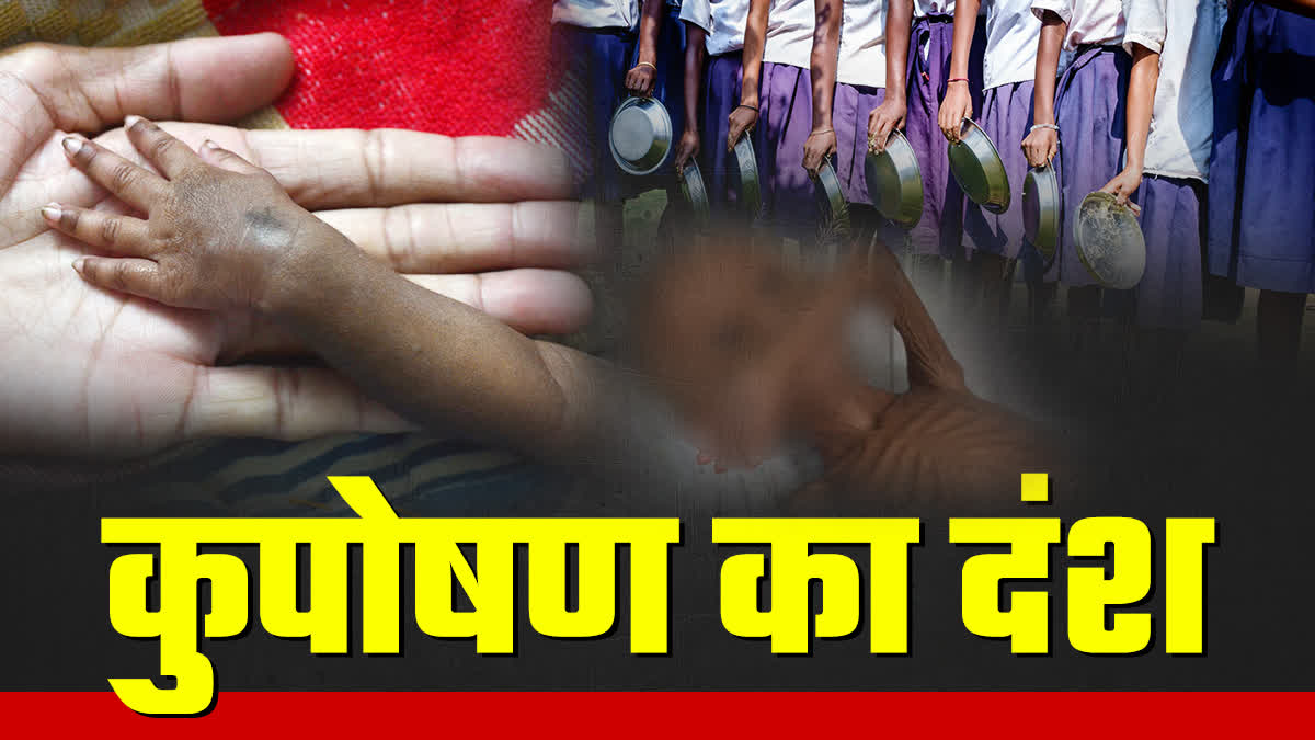 MALNUTRITION IN MADHYA PRADESH