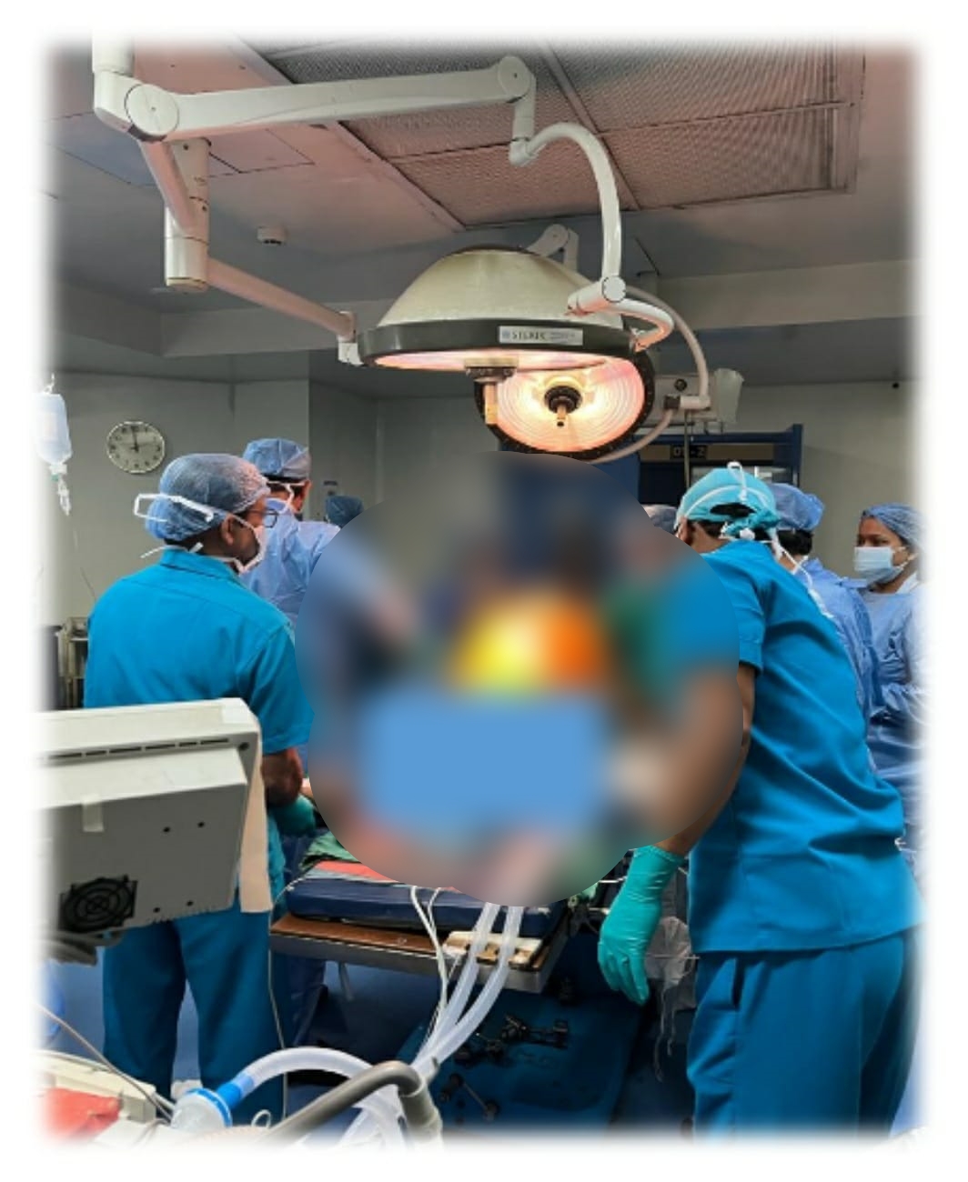 rare surgery in kolkata