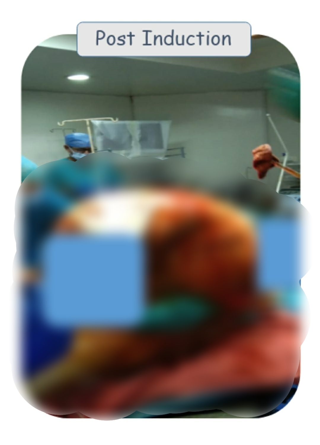 rare surgery in kolkata