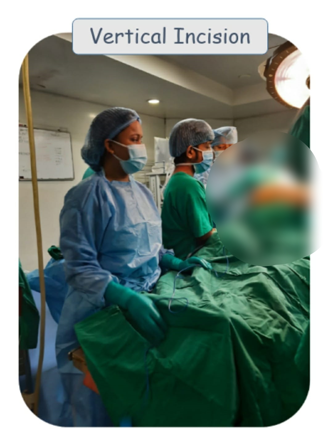 rare surgery in kolkata